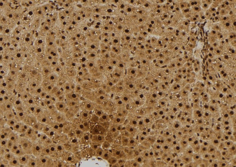 PARK2 / Parkin 2 Antibody