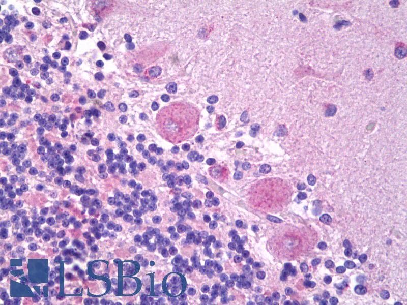 IHC-plus™ Polyclonal Rabbit anti-Human NPPB / BNP Antibody (Preservative Free, IHC)