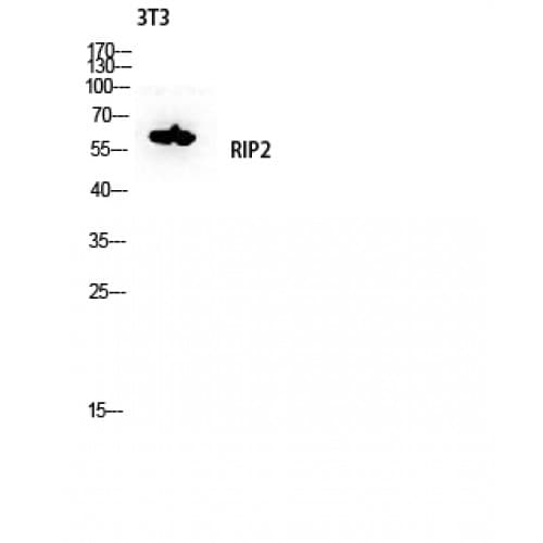 Polyclonal Rabbit anti-Human RICK / RIP2 Antibody (120-200 aa, IHC, WB)