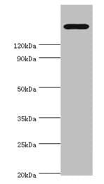 TRPM2 Antibody (aa1204-1503)