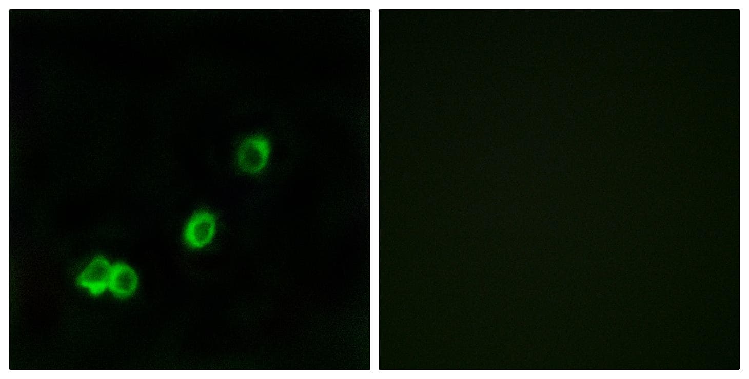 ACOT1 Antibody