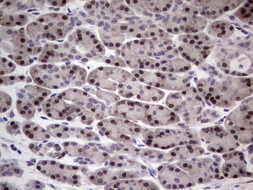 Monoclonal Mouse anti-Human RAD23B / HR23B Antibody (clone OTI7G10, aa1-253, IHC, WB)