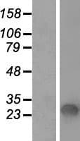 SFTPA1 / Surfactant Protein A (Over-Expression Lysate Myc-DDK (Flag))
