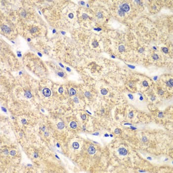 SCAD / ACADS Antibody