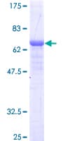 Human AGA / Aspartylglucosaminidase Protein (Recombinant GST)