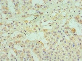 Polyclonal Rabbit anti-Human DPP2 / DPP7 Antibody (aa190-410, IHC, WB)