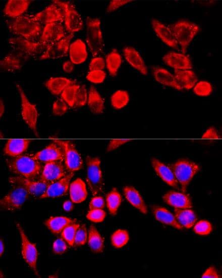 TRPC6 Antibody