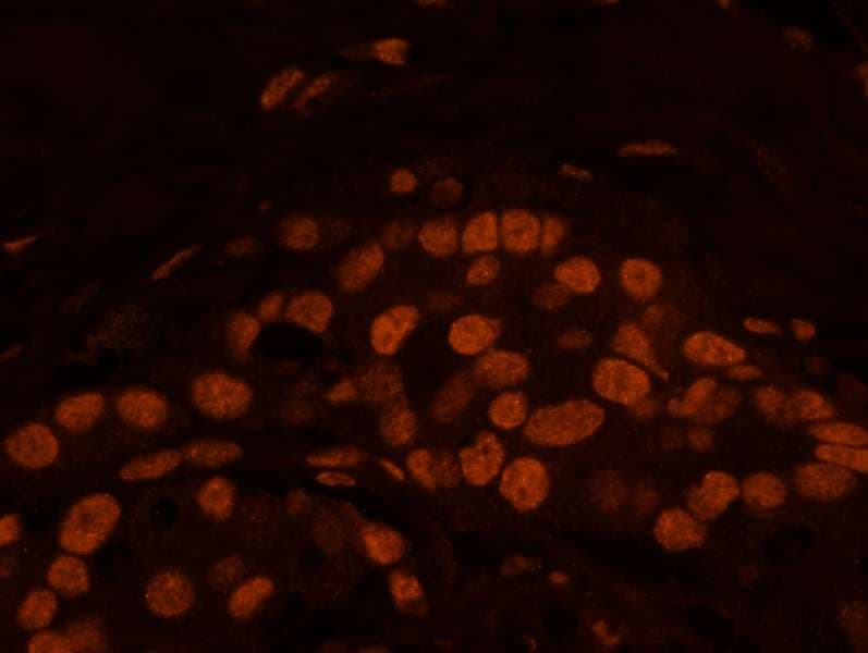 IHC-plus™ Polyclonal Rabbit anti-Human MATR3 / Matrin 3 Antibody (aa800-C-term, IHC, IF)