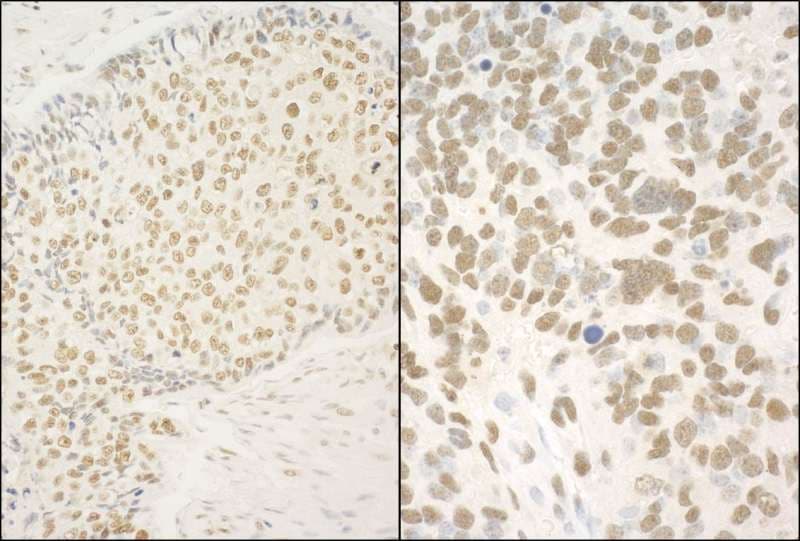 IHC-plus™ Polyclonal Rabbit anti-Human GMEB1 Antibody (aa523-573, IHC, WB)