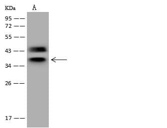 Polyclonal Rabbit anti-Human HNRNPC / HNRNP C Antibody (IHC, IF, WB)