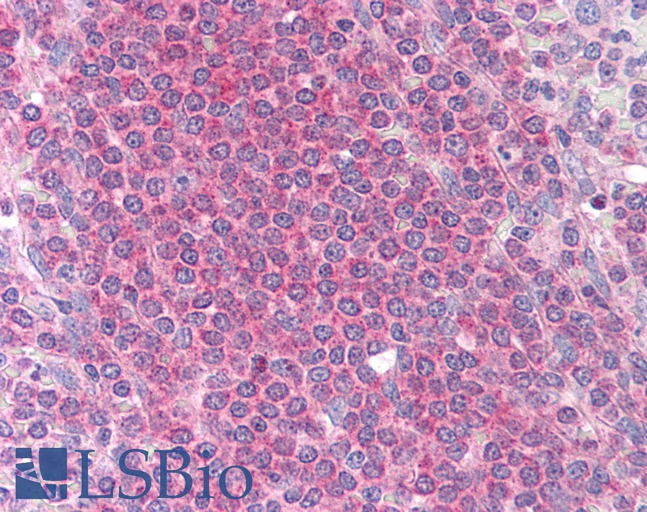 IHC-plus™ MCL1 / MCL 1 Antibody (clone 8C6D4B1)