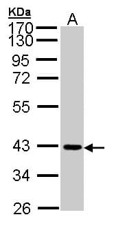 IHC-plus™ Polyclonal Rabbit anti-Human JAM2 Antibody (aa1-294, IHC, WB)