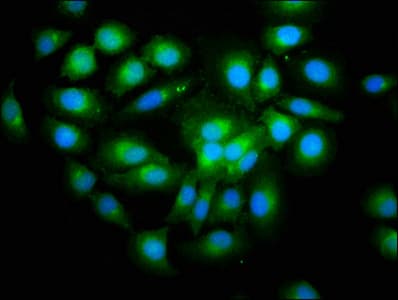 Polyclonal Rabbit anti-Human SHISA5 / SCOTIN Antibody (IHC)