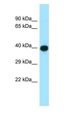 ADIPOR1/Adiponectin Receptor 1 Antibody (C-Terminus)