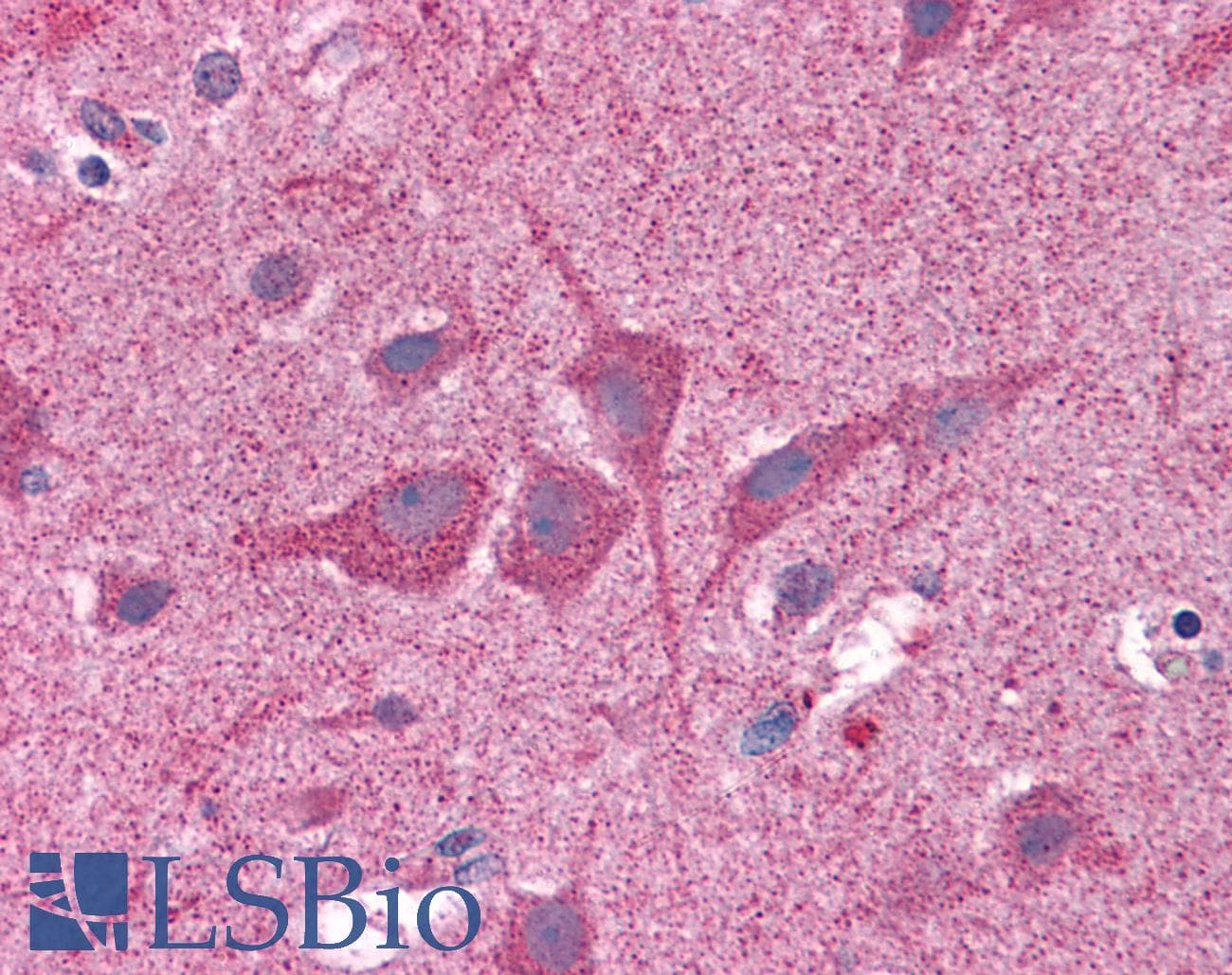 IHC-plus™ NUMB Antibody