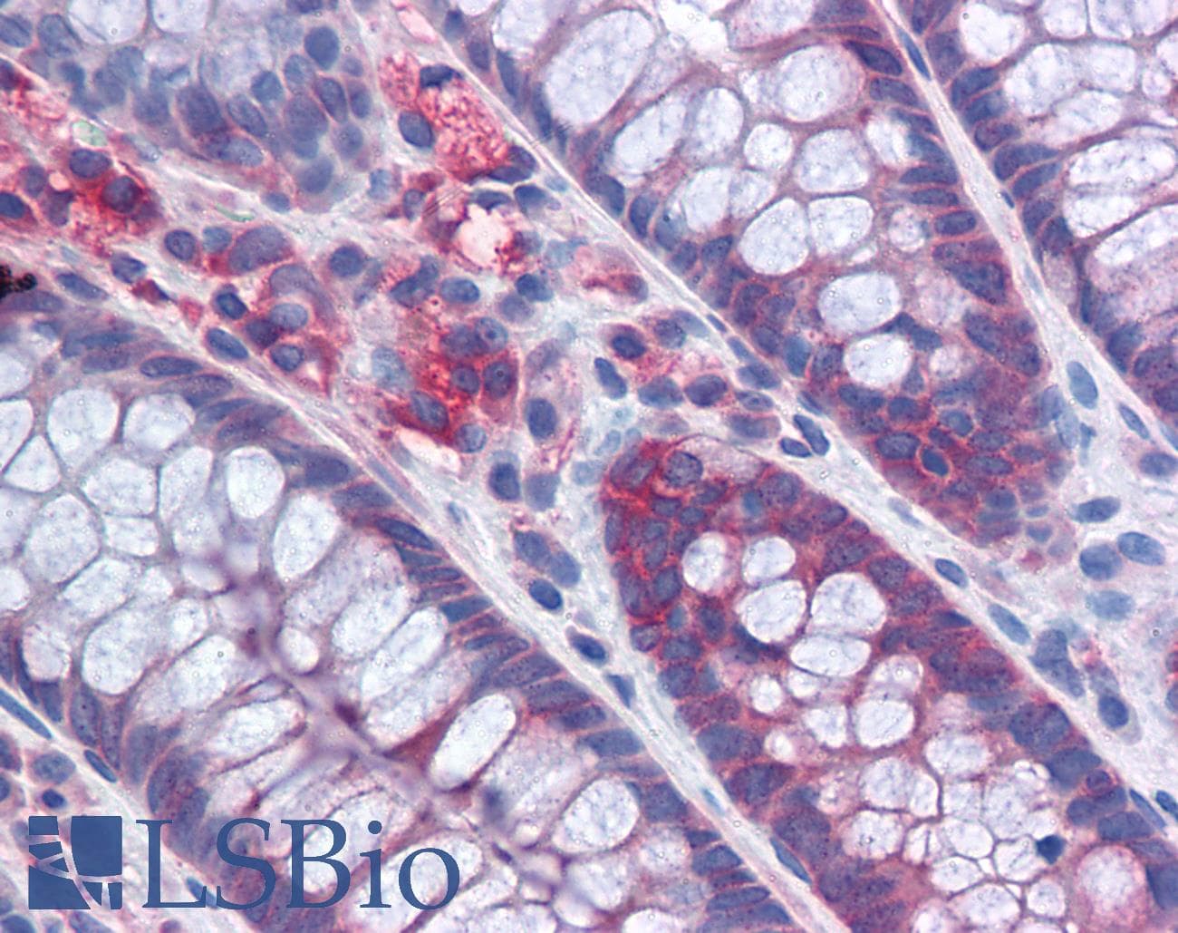 IHC-plus™ Monoclonal Mouse anti-Human G3BP1 / G3BP Antibody (clone 2F3, IHC, IF, WB)