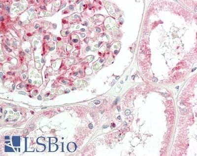 IHC-plus™ CTTN / Cortactin Antibody (aa388-437)