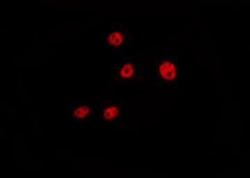 CCND1 / Cyclin D1 Antibody (phospho-Ser90)