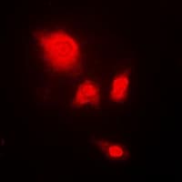 UCHL5 / UCH37 Antibody