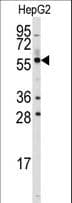 P5CDH / ALDH4A1 Antibody (aa533-561)