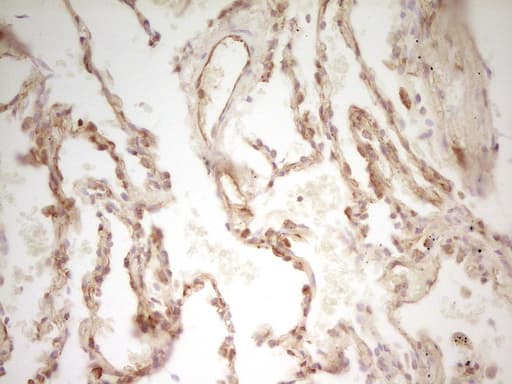 Monoclonal Mouse anti-Human PAK4 Antibody (clone OTI1C7, aa1-308, IHC, WB)