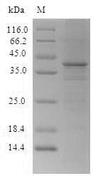 Human CTCF Protein (Recombinant 6His, N-terminus)