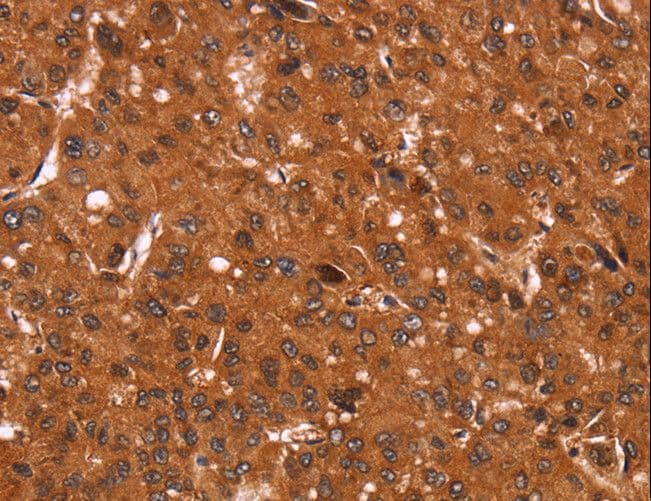CCND3 / Cyclin D3 Antibody