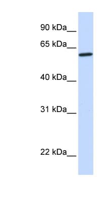 CYP27 / CYP27A1 Antibody (aa432-481)