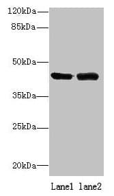 Polyclonal Rabbit anti-Human ALS2CR1 / NIF3L1 Antibody (IHC, WB)