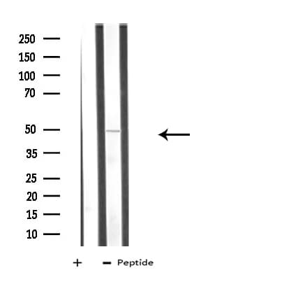 AUTL1 / ATG4C Antibody