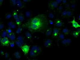 PRL / Prolactin Antibody (clone OTI2E4)