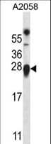 TMED9 Antibody (aa169-198)