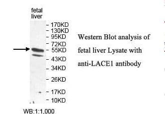 Polyclonal Rabbit anti-Human LACE1 Antibody (aa4-201, IHC, WB)