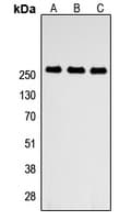 Polyclonal Rabbit anti-Human ABCA4 Antibody (Internal, WB)