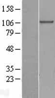 COPB1 / Beta-COP Protein (Over-Expression Lysate Myc-DDK (Flag))