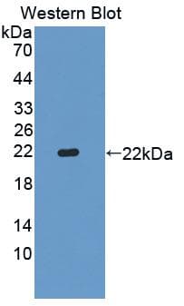 SHBG Antibody (aa53-214)