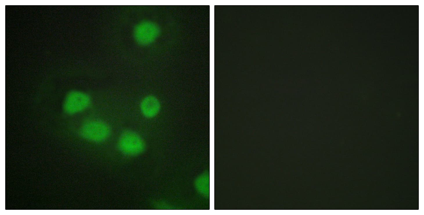 Polyclonal Rabbit anti-Human SIX6 Antibody (aa121-170, IF, WB)