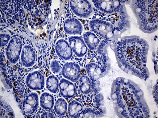 NCAM / CD56 Antibody (aa20-718, clone UMAB83, Carrier-free)