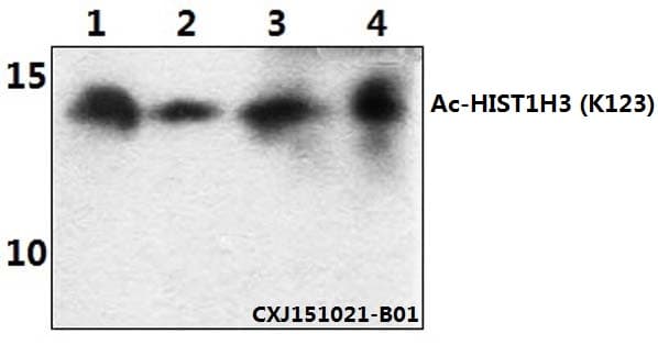 Polyclonal Rabbit anti-Human Histone H3 Antibody (Acetyl-Lys123, WB)