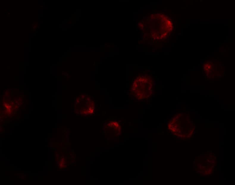 IHC-plus™ P2RX7 / P2X7 Antibody