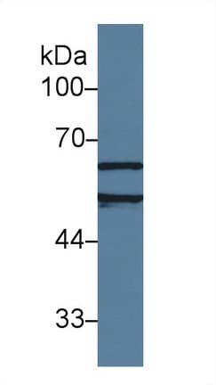 ACHE / Acetylcholinesterase Antibody (aa157-332)