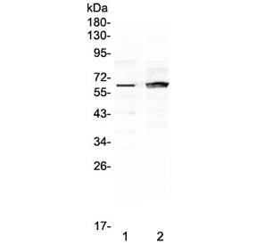 FZD4 / Frizzled 4 Antibody