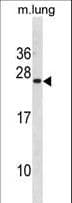 Polyclonal Rabbit anti-Human ISCU Antibody (aa138-167, WB)