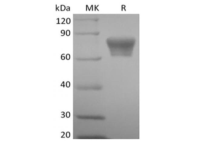 Mouse TNFRSF1B / TNFR2 Protein (Recombinant Fc, C-terminus)