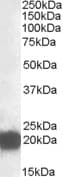 IHC-plus™ Polyclonal Goat anti-Human CSRP3 Antibody (aa150-163, IHC, WB)