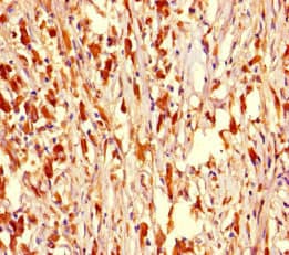NR1H2 / LXR Beta Antibody