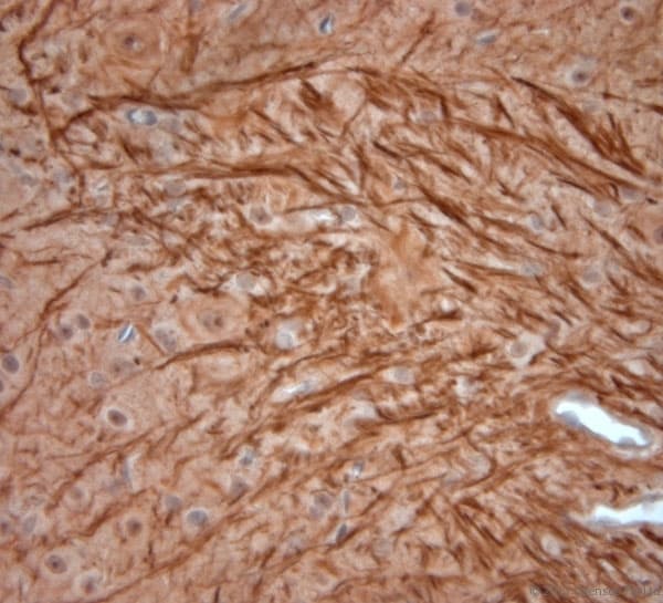 NEFH / NF-H Antibody (aa150-200)