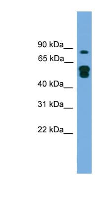 TLDC1 / KIAA1609 Antibody (N-Terminus)