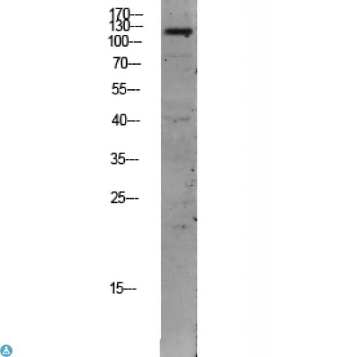TEK / TIE2 Antibody