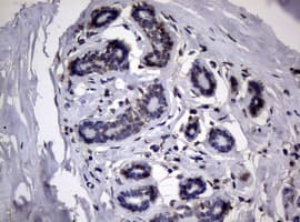 R1 / RRM1 Antibody (aa541-792, clone OTI5G5, Carrier-free)